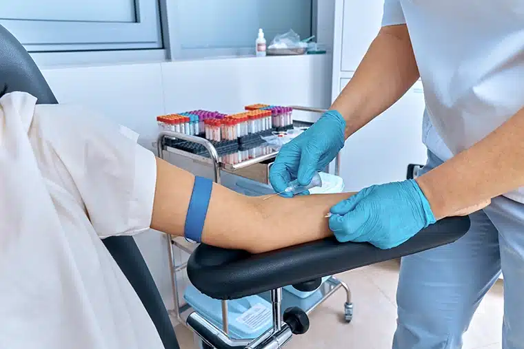 Vascular Testing